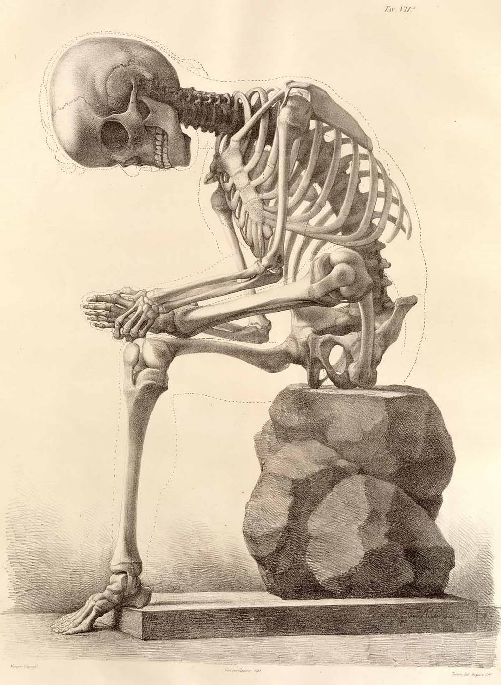 15 Free Vintage Medical Halloween Images | Bekob.com