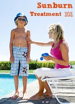 Sunburn Treatment 101 | Tipsaholic.com #sunburn #remedy #prevention #treatment #outdoors